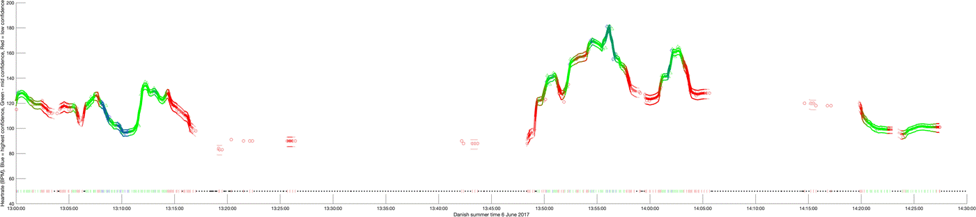 A graph of heart rate over time

Description automatically generated with medium confidence